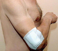 Anwendung Arm